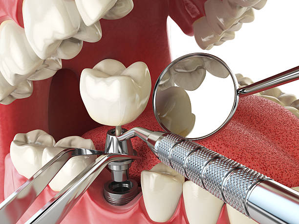 Best Emergency Dentist for Special Needs Patients in Trowbridge Park, MI