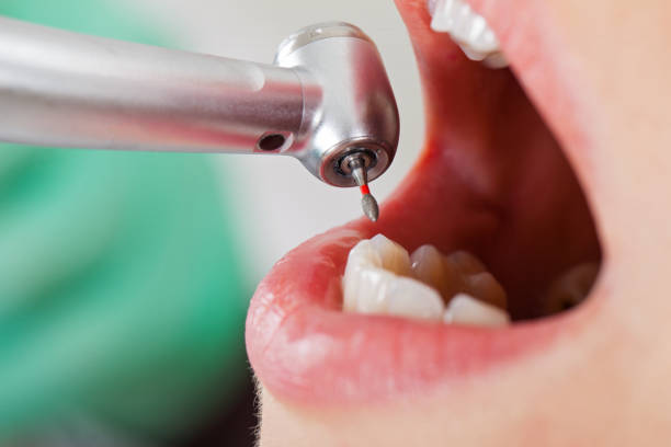 Best Emergency Root Canal Treatment in Trowbridge Park, MI